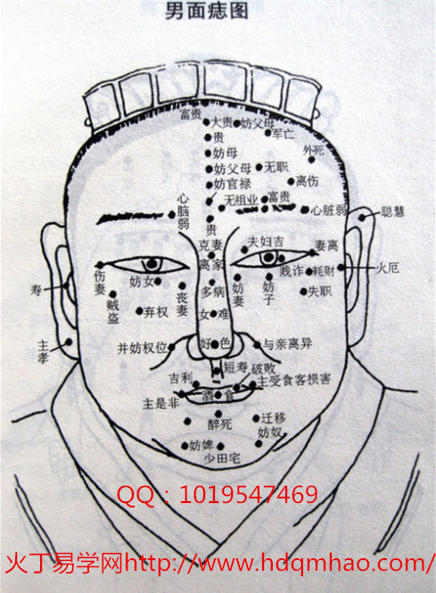 印堂有痣男性显贵,女性显富.   四,天庭有痣:妨身.